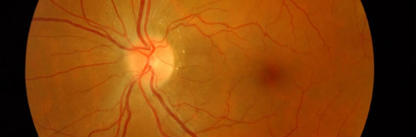 Medical Retina
